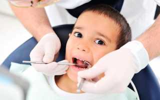 Кариес молочных зубов: о чем важно помнить родителям