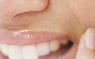 Синяк после обезболивания зуба: причины появления, чем опасен, как лечить