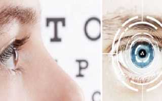 Сколько длится восстановление после лазерной коррекции зрения?