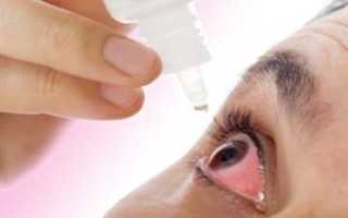 Какие противоаллергические капли для глаз самые эффективные для взрослых и детей?