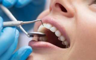 Клиника, дифференциальная диагностика кариеса зубов