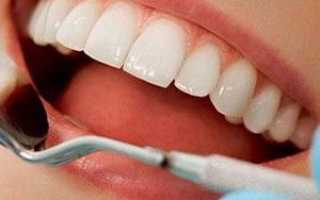 Можно ли проводить профессиональную чистку зубов при беременности?