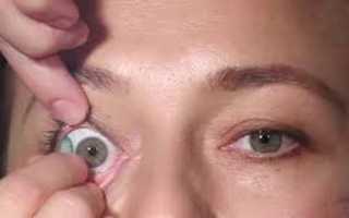 Почему после линз могут болеть глаза и что делать в такой ситуации?
