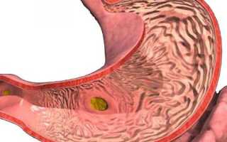 Симптомы больного желудка: правильное определение заболеваний органа