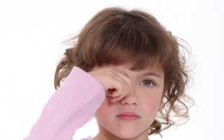 Как распознать гнойный конъюнктивит у детей: лечение, особенности заболевания глаз