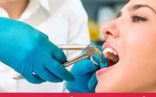 Как правильно чистить зубы – от зубной нити и щетки до профессиональной чистки в клинике