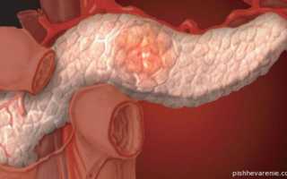 Липоматоз поджелудочной железы: симптоматика и лечебные меры