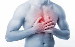 Симптомы межреберной невралгии грудного отдела