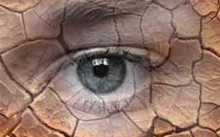Причины возникновения сухости глаз. Народные средства лечения могут быть эффективней традиционной терапии