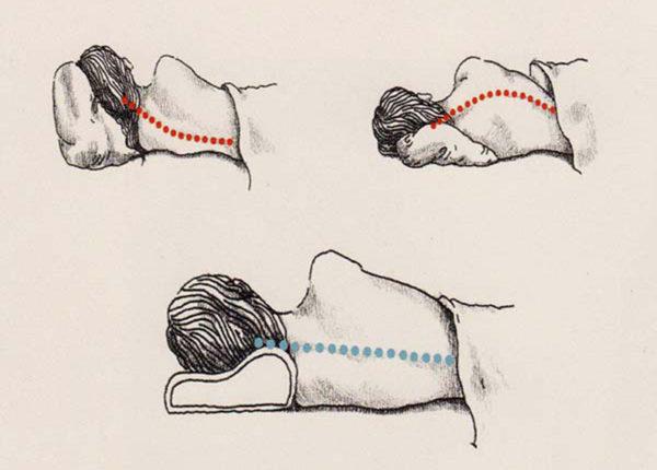 Как правильно спать при шейном остеохондрозе