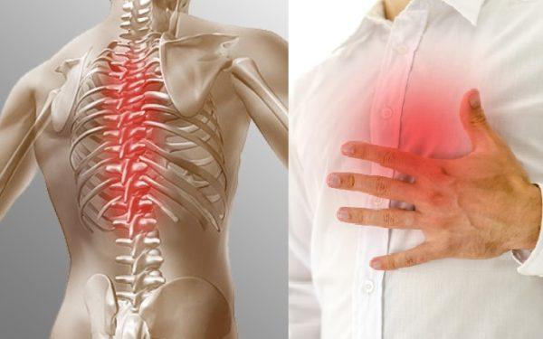 Боль при остеохондрозе часто принимают за проявление стенокардии