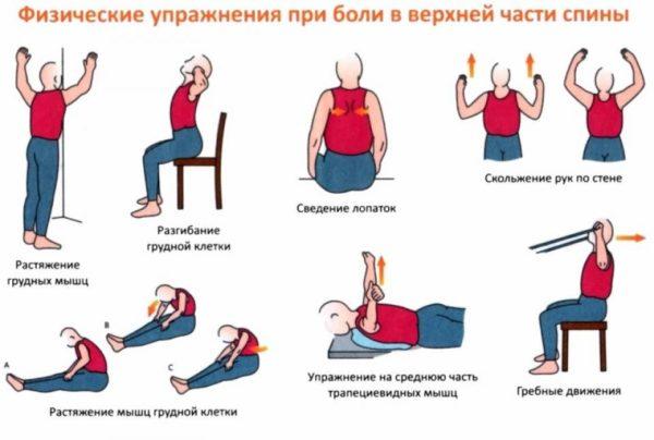 Физические упражнения при боли в верхней части спины