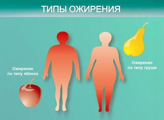 Типы ожирения
